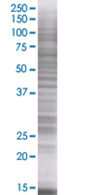 DKK4 transfected lysate.