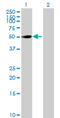 Lane 1: PFKFB1 transfected lysate (51.92 KDa) Lane 2: Non-transfected lysate.
