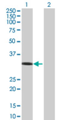 Lane 1: RAD51 transfected lysate (37 KDa) Lane 2: Non-transfected lysate.