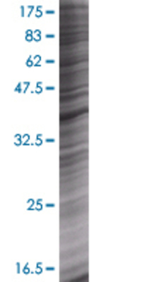 RAD51AP1 transfected lysate.