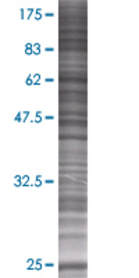 SSX1 transfected lysate.