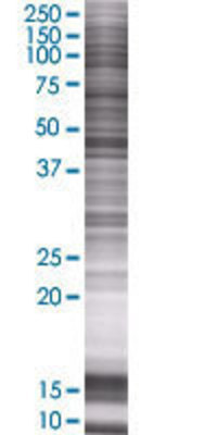 IPMK transfected lysate.
