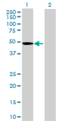 Lane 1: IPMK transfected lysate (45.87 KDa) Lane 2: Non-transfected lysate.