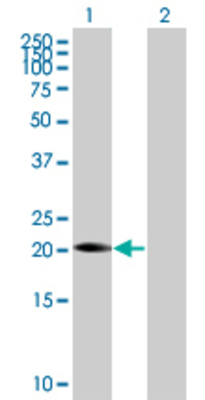 Lane 1: FGF19 transfected lysate (24 KDa) Lane 2: Non-transfected lysate.