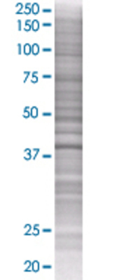 POLB transfected lysate.