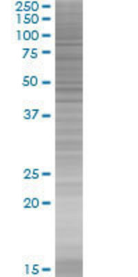 ZNF398 transfected lysate.