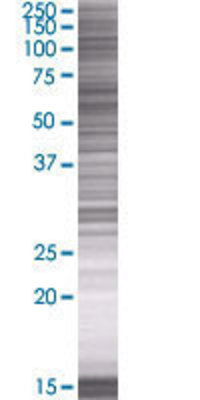 PATZ1 transfected lysate.