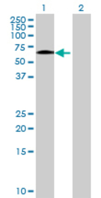 Lane 1: PATZ1 transfected lysate (59.18 KDa) Lane 2: Non-transfected lysate.