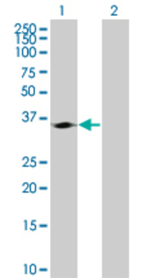 Lane 1: CDK4 transfected lysate (33.33 KDa). Lane 2: Non-transfected lysate.
