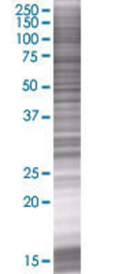 DCK transfected lysate.