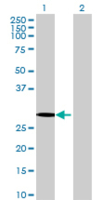 Lane 1: DCK transfected lysate (28.71 KDa) Lane 2: Non-transfected lysate.