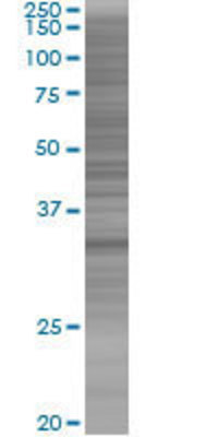 OGG1 transfected lysate.