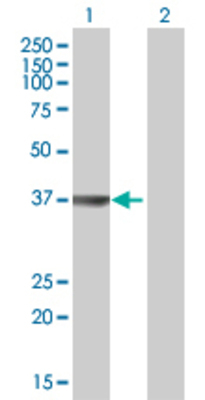 Lane 1: OGG1 transfected lysate (36.4 KDa) Lane 2: Non-transfected lysate.