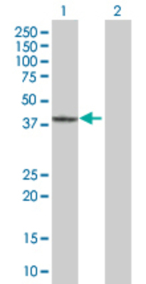 Lane 1: GRAP2 transfected lysate (36.3 KDa). Lane 2: Non-transfected lysate.