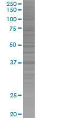 ELAVL4 transfected lysate.