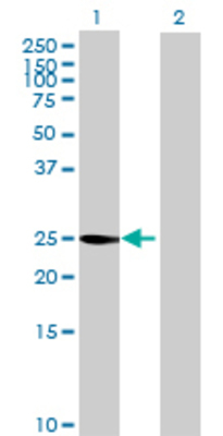 Lane 1: GAMT transfected lysate (26.07 KDa) Lane 2: Non-transfected lysate.