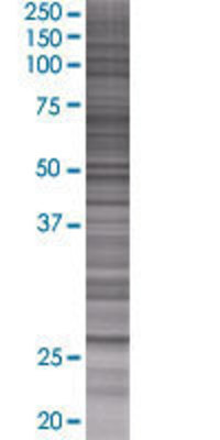 GAMT transfected lysate.