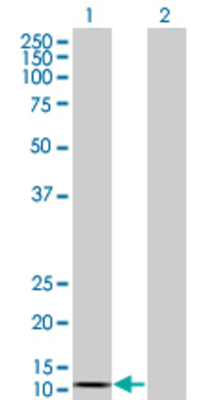 Lane 1: CCL2 transfected lysate (11 KDa). Lane 2: Non-transfected lysate.