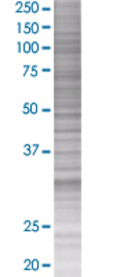 RNF138 transfected lysate.