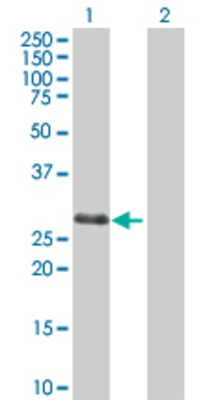Lane 1: RNF138 transfected lysate (28.2 KDa) Lane 2: Non-transfected lysate.