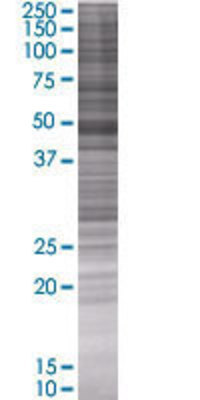 SNIP1 transfected lysate.