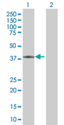 Lane 1: CD5L transfected lysate (38.1 KDa). Lane 2: Non-transfected lysate.