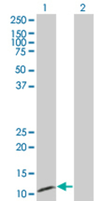 Lane 1: CLPS transfected lysate (12.43 KDa) Lane 2: Non-transfected lysate.