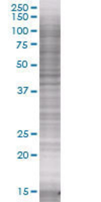 FLT1 transfected lysate.