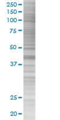NEIL2 transfected lysate.