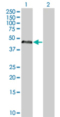Lane 1: PRKAR1A transfected lysate (43 KDa) Lane 2: Non-transfected lysate.