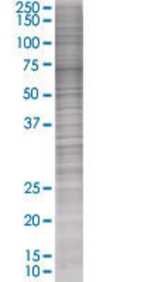 RND3 transfected lysate.