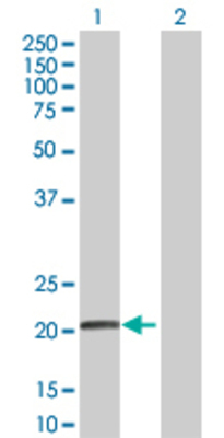 Lane 1: CSH2 transfected lysate (25 KDa) Lane 2: Non-transfected lysate.
