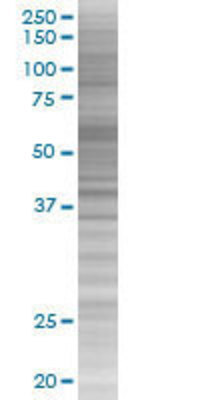 SELP transfected lysate.