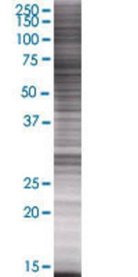 ATP6V0C transfected lysate.