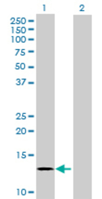 Lane 1: ATP6V0C transfected lysate (17.16 KDa) Lane 2: Non-transfected lysate.