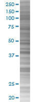 SHOX2 transfected lysate.