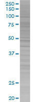 GNL1 transfected lysate.