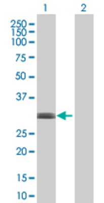 Lane 1: TAC1 transfected lysate (14.3 KDa) Lane 2: Non-transfected lysate.