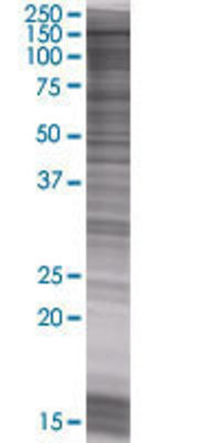 SETDB1 transfected lysate.