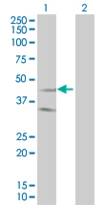 Lane 1: SSTR2 transfected lysate (40.7 KDa). Lane 2: Non-transfected lysate.