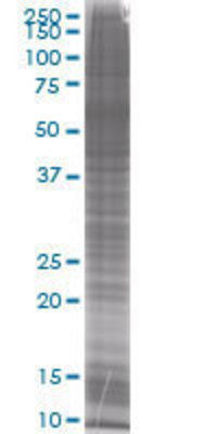 SSTR2 transfected lysate