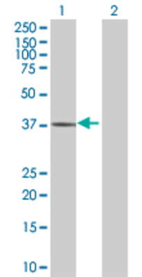 Lane 1: ARG1 transfected lysate (34.7 KDa) Lane 2: Non-transfected lysate.