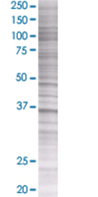 ARG1 transfected lysate.