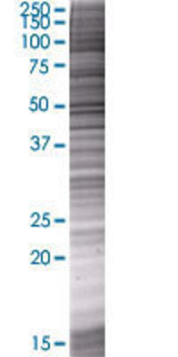 SMAP1 transfected lysate.