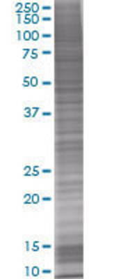 HLA-DOA transfected lysate