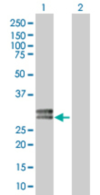 Lane 1: HLA-DOA transfected lysate (27.61 KDa). Lane 2: Non-transfected lysate.