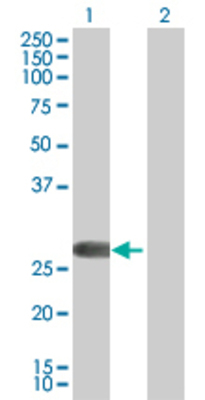 Lane 1: FHL2 transfected lysate (32.2 KDa) Lane 2: Non-transfected lysate.
