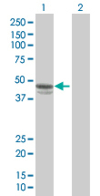 Lane 1: SERPINE1 transfected lysate (45.1 KDa). Lane 2: Non-transfected lysate.