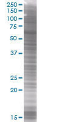 SERPINE1 transfected lysate