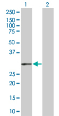 Lane 1: PIR transfected lysate (32.01 KDa) Lane 2: Non-transfected lysate.